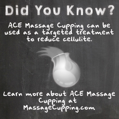 Did You Know? ACE Massage Cupping™ Can Reduce Cellulite