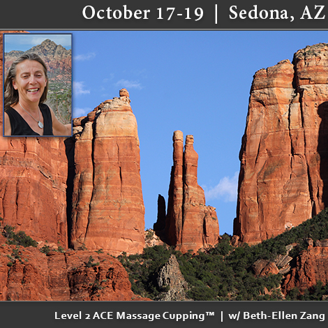 ACE Massage Cupping Level 2 Workshop – October 17 – 19 in Sedona, AZ