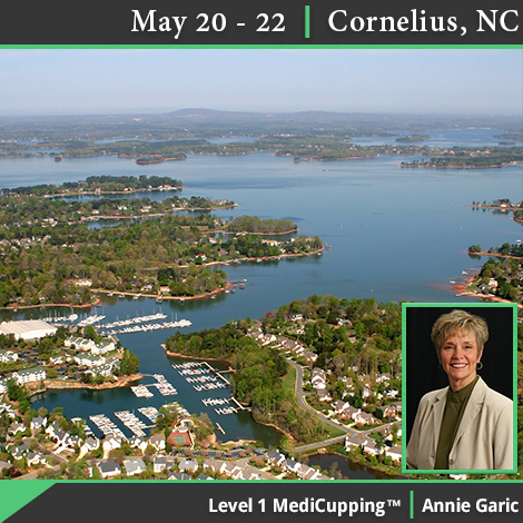 Level 1 MediCupping Workshop — May 20-22 in Cornelius, NC