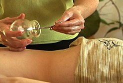 Massage Cupping Therapy for Healthcare Professionals
