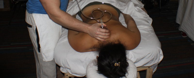 What is MediCupping Vacuum Cupping Therapy?