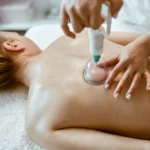 The Holistic Benefits of Cupping Therapy
