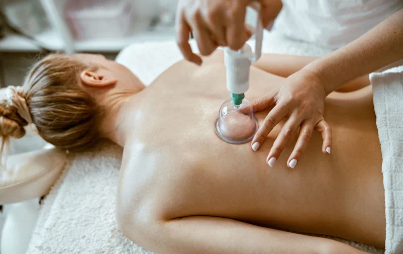 The Holistic Benefits of Cupping Therapy: Addressing Physical, Mental, and Emotional Health