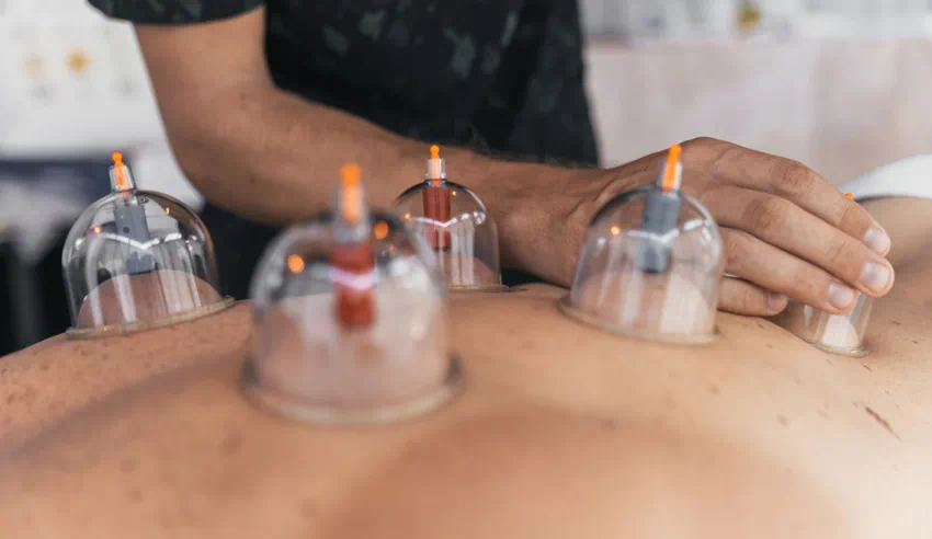Discover the Athletic Performance Benefits of Cupping Therapy